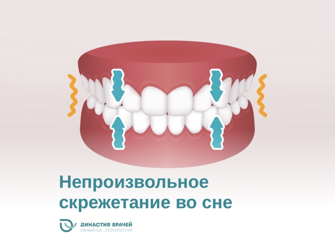 Как перестать скрипеть зубами