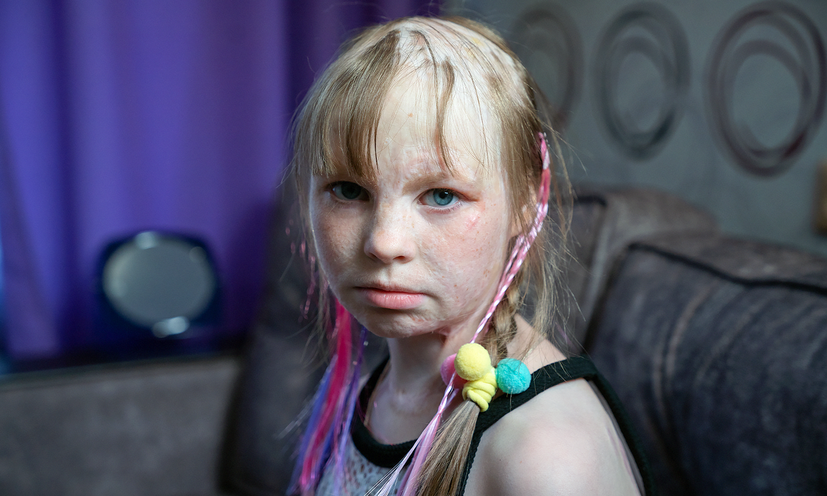 Алеся Петракова, подопечная фонда "Алёша"