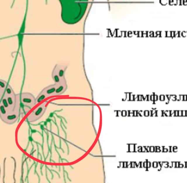 Увеличение лимфатических узлов в паховой области