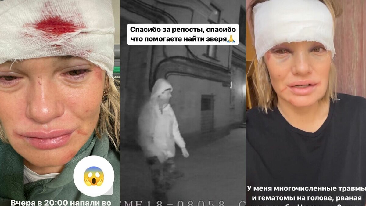     Гражданин справлял нужду на улице. Девушка его пристыдила и стала жертвой нападения.