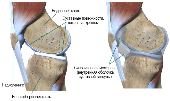 Выпот в полости коленного сустава