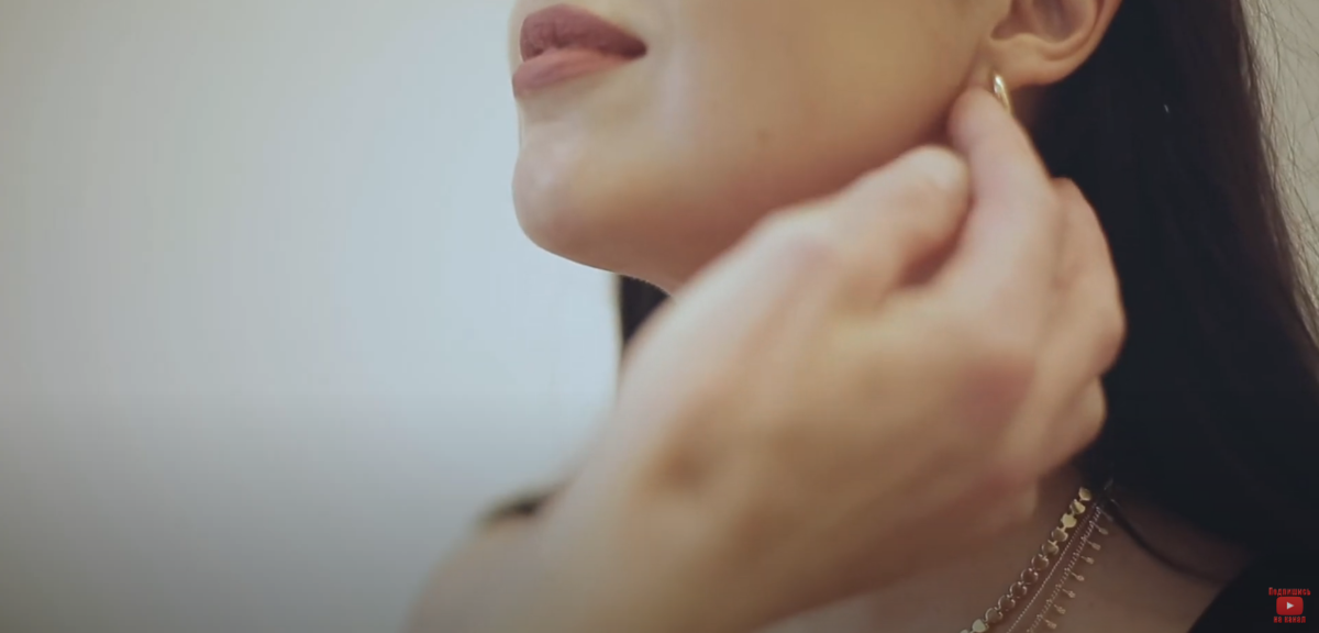 Результаты липосакции подбородка через 4 месяца 