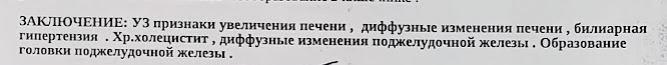 Вот так вот бывает.