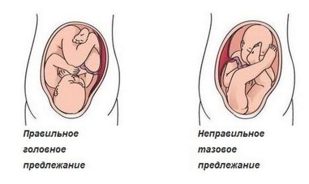 Позы при беременности во время секса 3 триместр