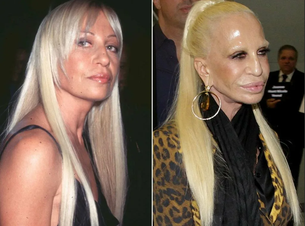 Janice Dickson Haircut and color, Celebrity plastic surgery, Old celebrities