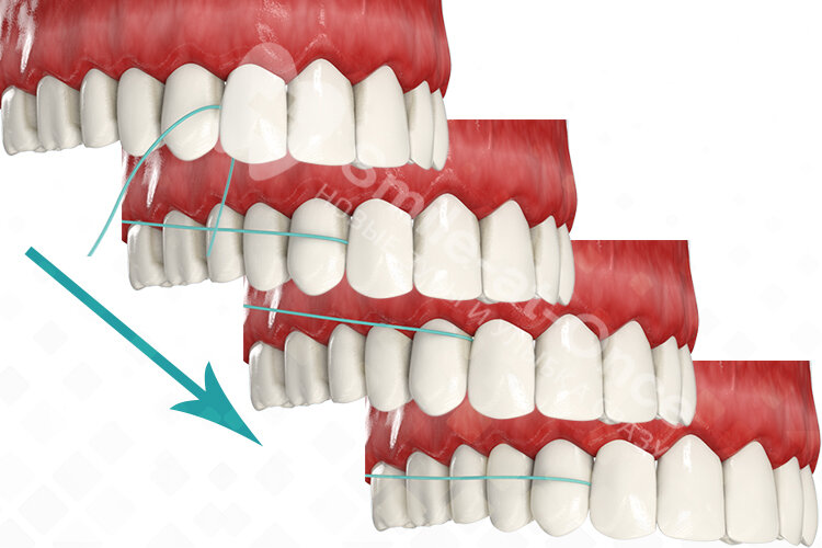 Профессиональная гигиена полости рта
