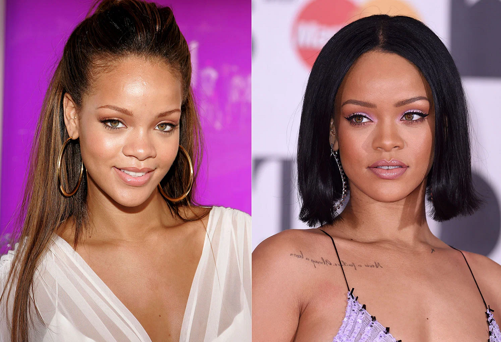 Певица Рианна до и после пластических операций