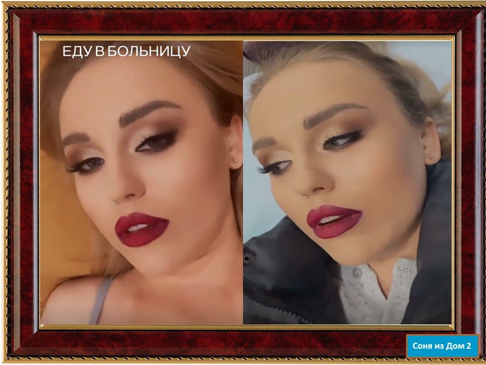 -2