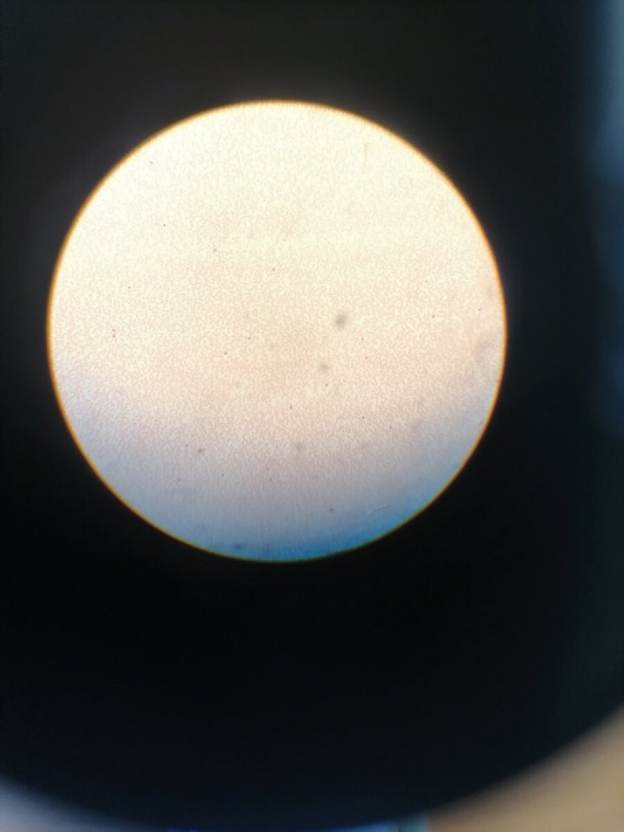 Малярийный плазмодий (Plasmodium malaria)