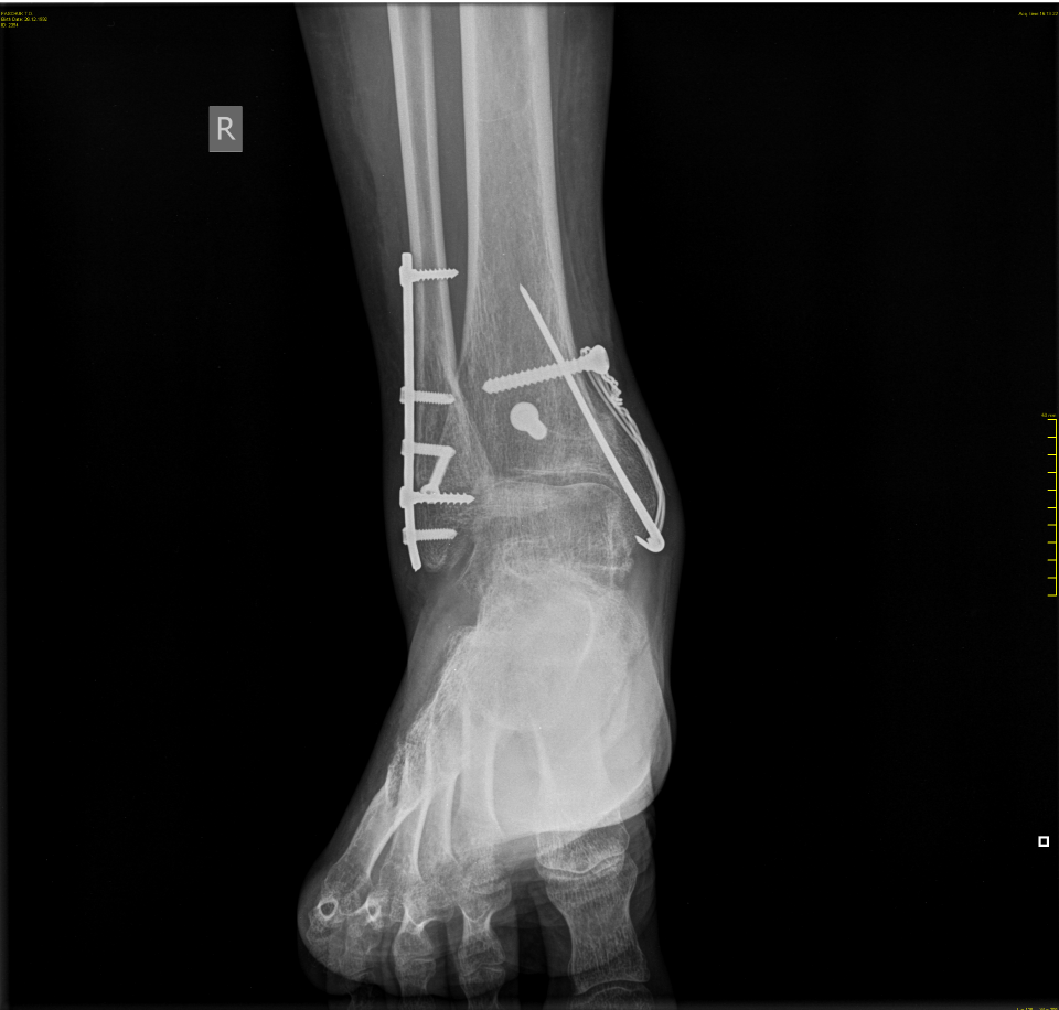 Вот так видят меня на просвет в аэропорту.