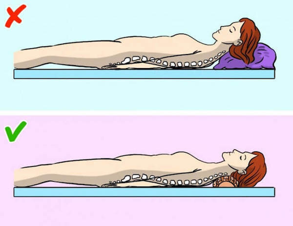 Неправильное и правильное  положение позвоночника  во время сна. 