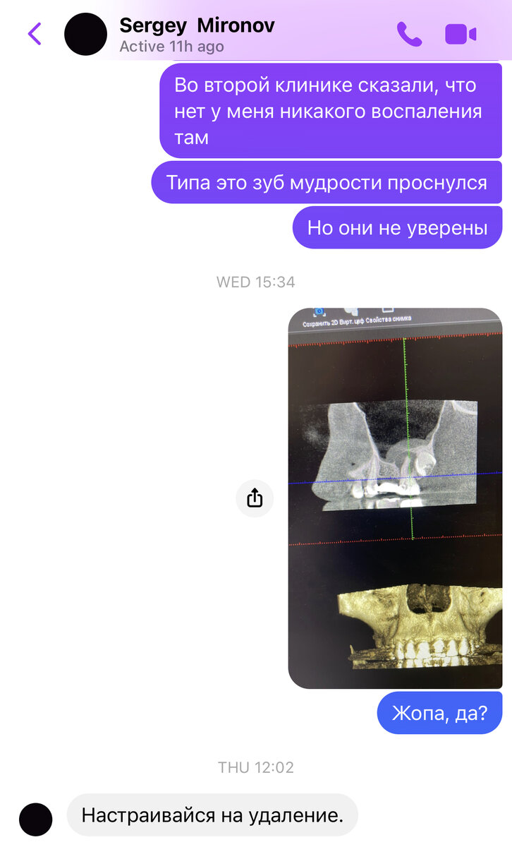 Ну конечно же, это не жопа, а голова!