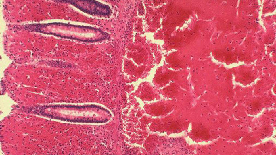 Фото: © Global look press/Custom Medical Stock Photo