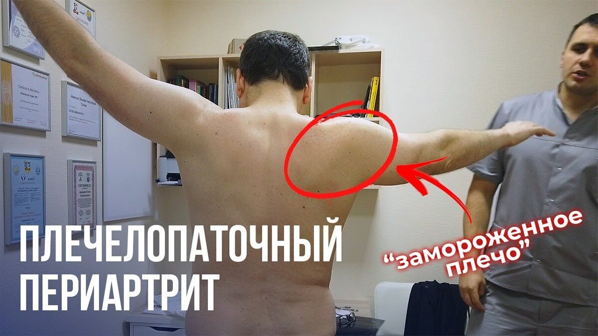 Картинка из интернета. Правая рука не поднимается выше, у меня было также