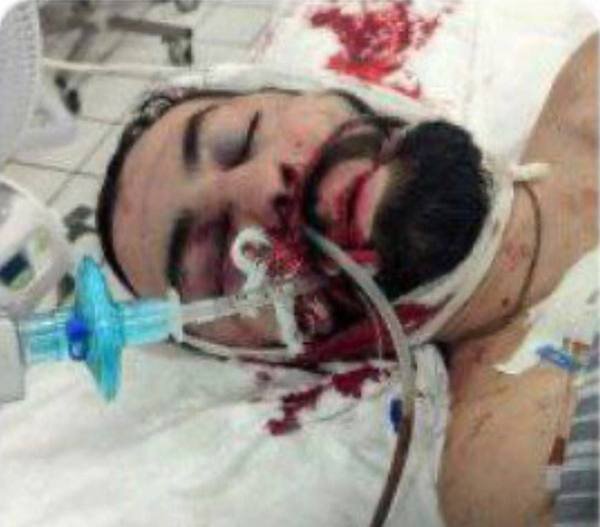    Покушение на убийство: в ЛНР получил ранение в голову командир подразделения Игорь Мангушев