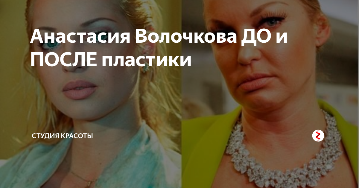 Анастасия Волочкова в молодости: просто волшебная девушка