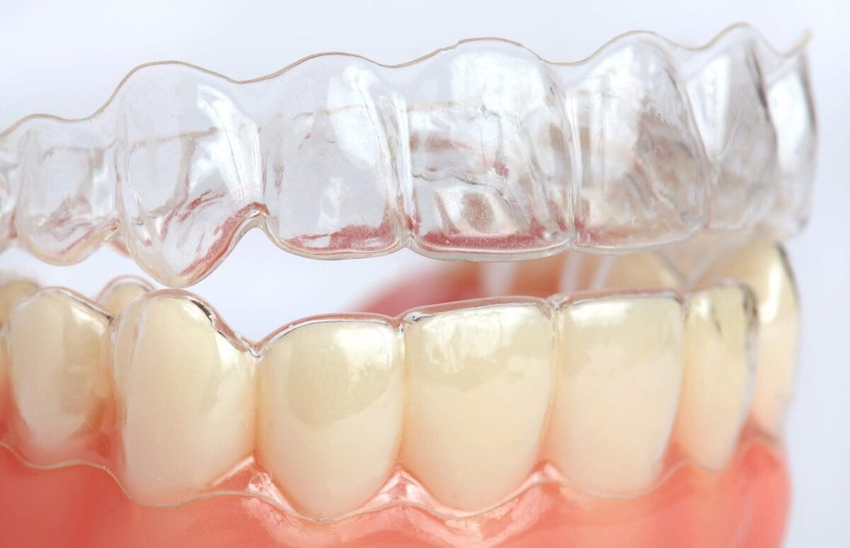 5 тенденций, меняющих современную стоматологию