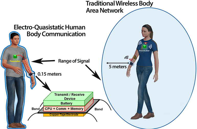 Новый способ защиты имплантатов и носимых на теле устройств от хакеров 