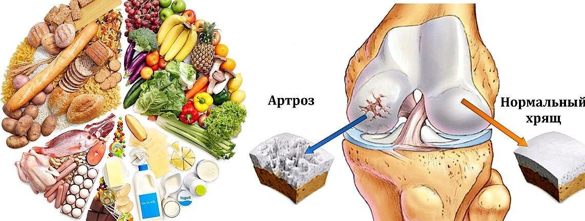 Артроз - лечение, диагностика, симптомы и причины | Клиника доктора Длина