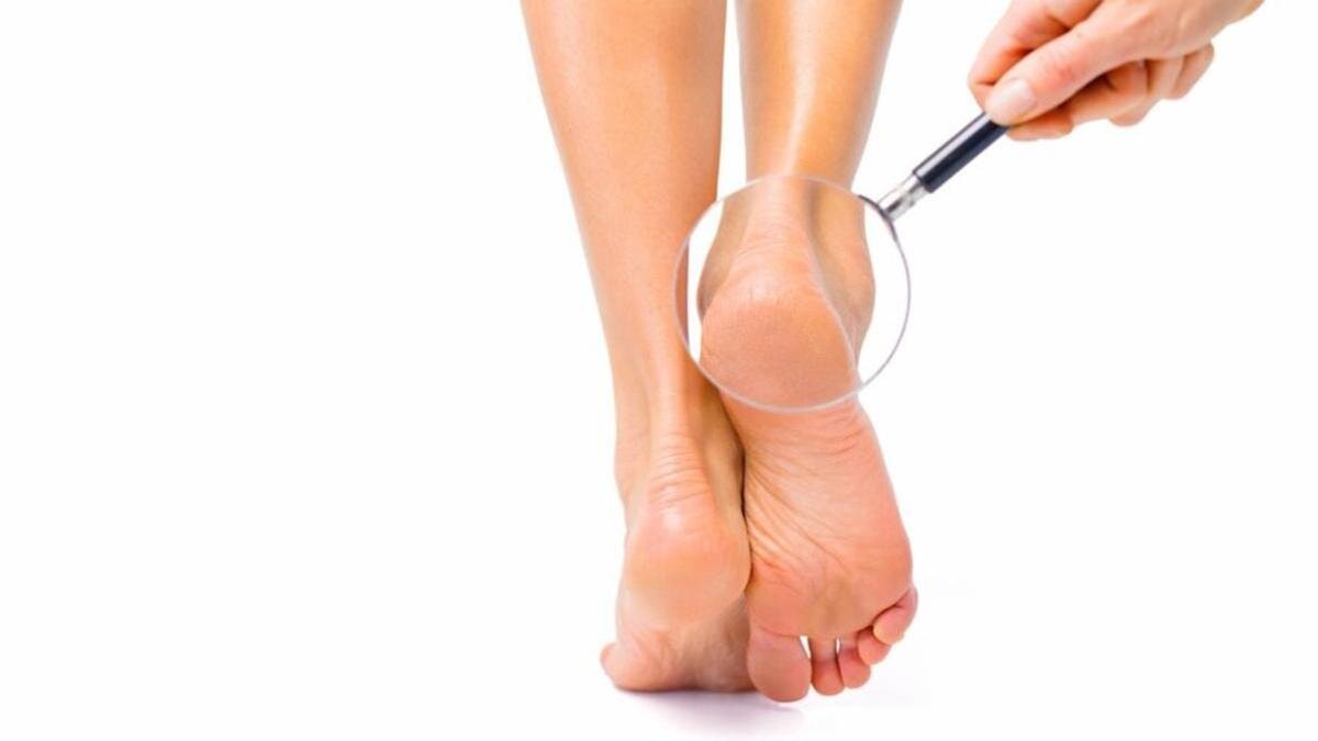    Лупа наведена на пятку:Freepik