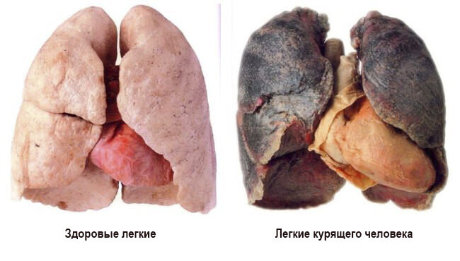 Фото с сайта https://ne-kurim.ru/articles/zdorovie/legkie-kurilshika/ 