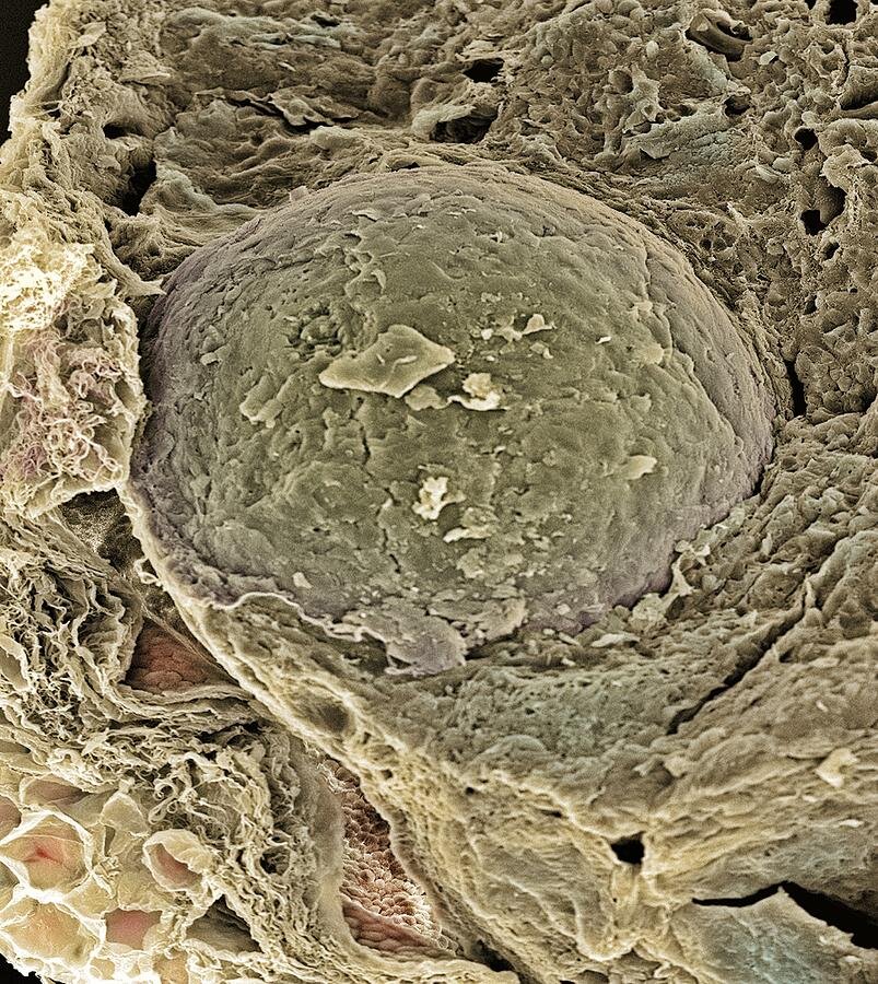 Ооцит Sem Photograph by Steve Gschmeissner