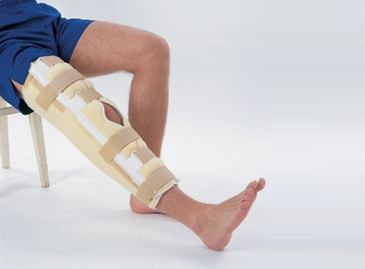 Ортопедическая операция ног. Ортез SKN 401. SKN 401 тутор на коленный сустав. Ортез при переломе бедренной кости. Гипсовая лонгета при переломе.