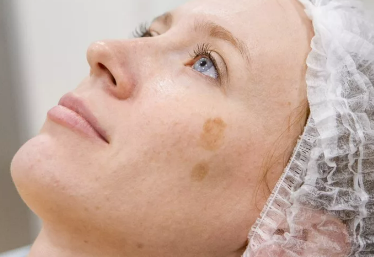 Фотография взята из источника beautyinsider.ru 