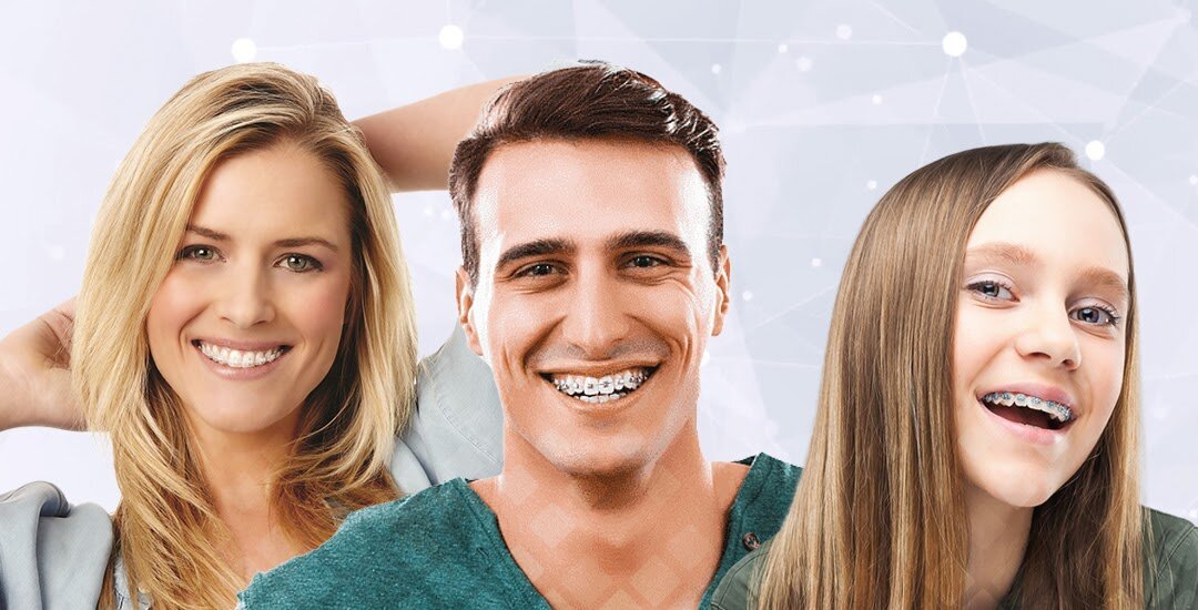 В зависимости от модели брекеты смотрятся на зубах совершенно по-разному. Фотоколлаж: Smile-at-Once.ru.
