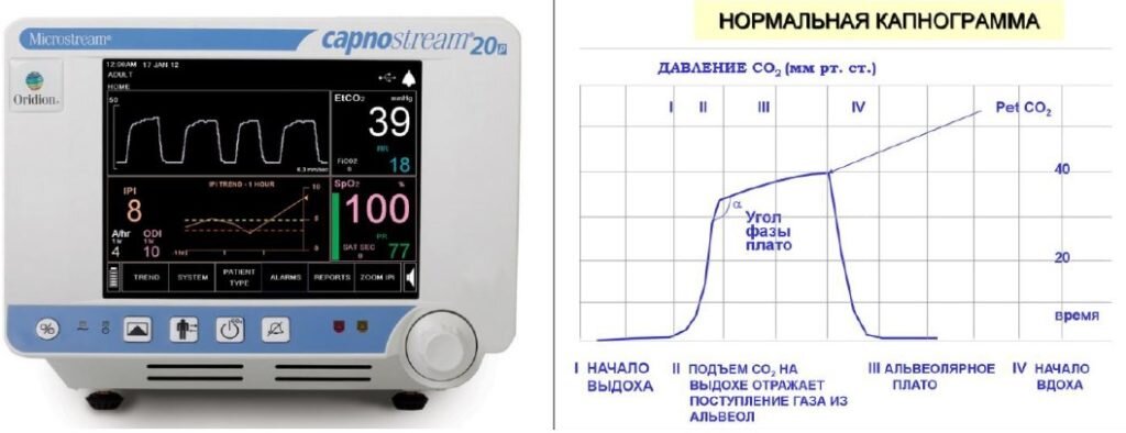 Капнометрия в анестезиологии и реаниматологии