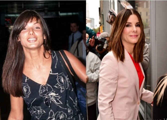 Остановить разрушительные процессы в организме может хорошая генетика и ЗОЖ или восполнение недостающих с возрастом компонентов, хотя замаскировать под силу и пластической хирургии, что тоже вариант. Источник: sandrabullockweb.com 