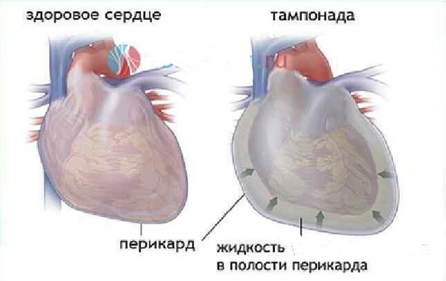 Изображение с сайта: sosudinfo.ru
