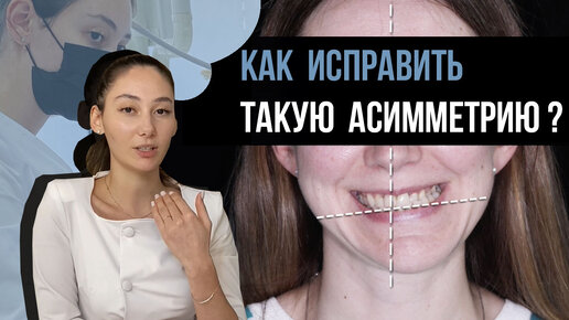 Как ортодонт может исправить сильную асимметрию лица?