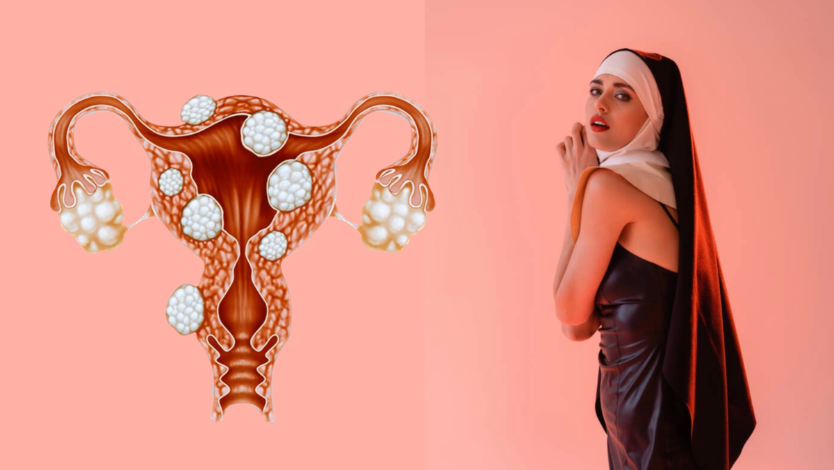 Миома матки - болезнь "Монашек"