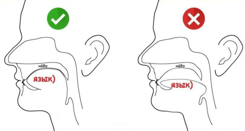 Что такое мьюинг и правда, что с его помощью можно выровнять зубы ...