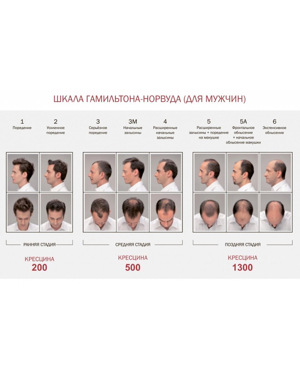 Шкала Гамильтона-Норвуда (для мужчин)