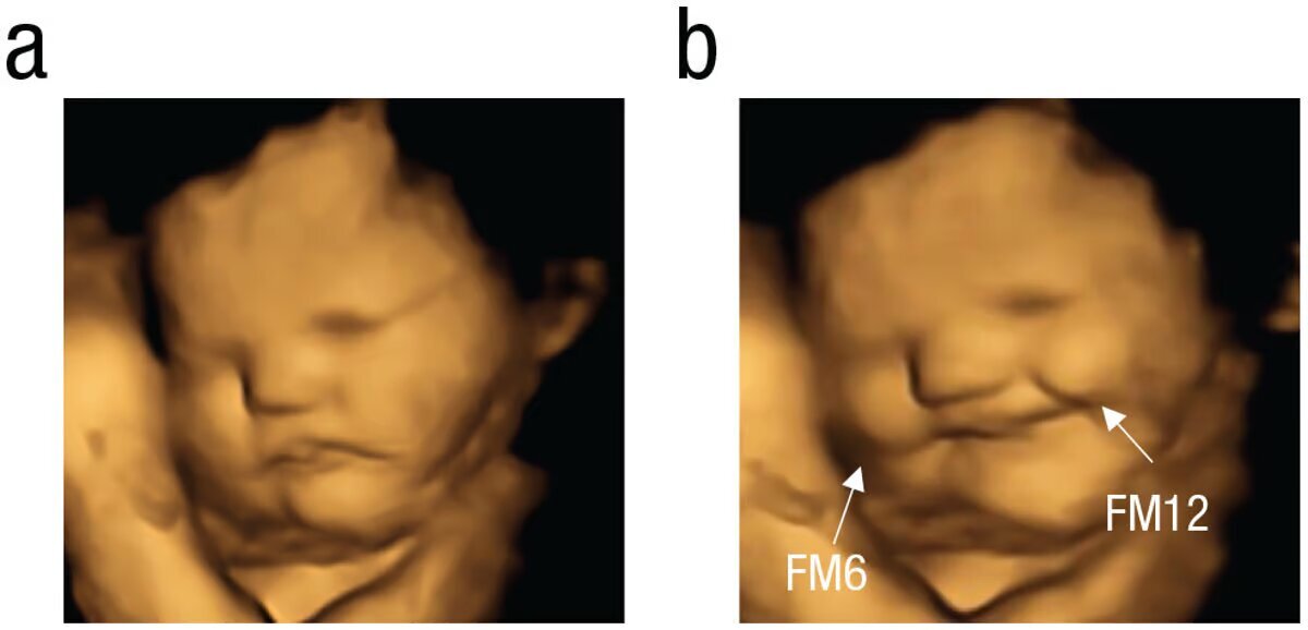 Илюстрация FETAP (Fetal Taste Preferences) Study, Fetal and Neonatal Research Lab, Durham University