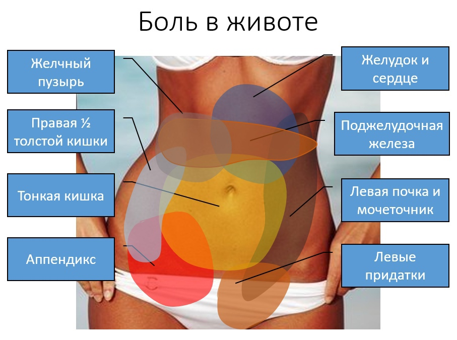 Примерная локализация болей в животе при различных заболеваниях