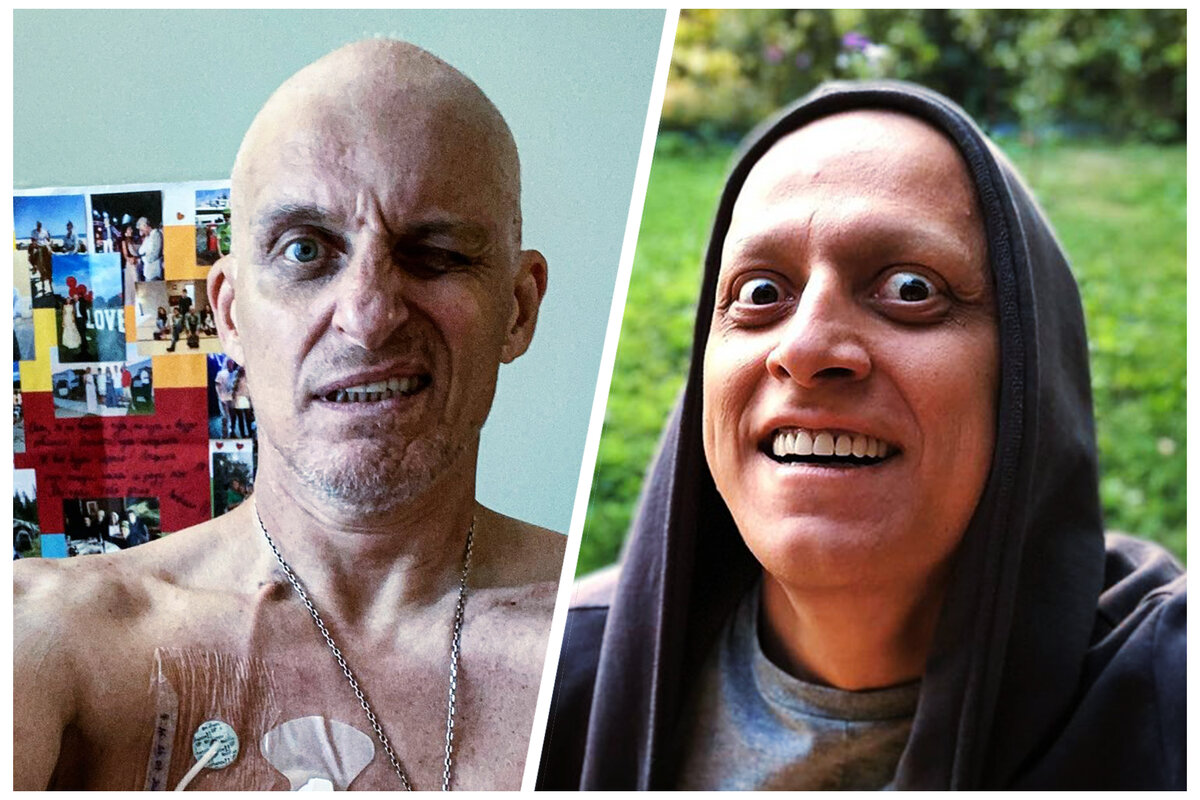 Победили рак сами. Знаменитости русские которые болели онкологией. Раковые больные фото до и после. Онкоблогеры самые известные русские.
