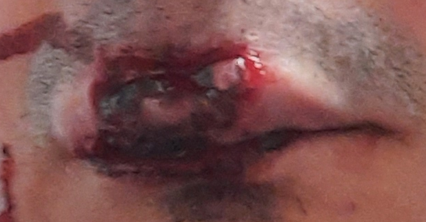 вот губа до качество так себе 