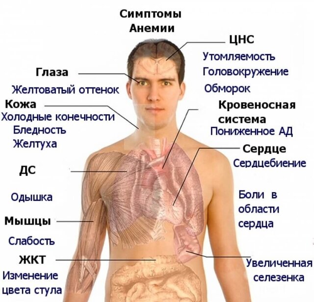 Признаки наличия анемии