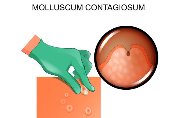 Яндекс картинки