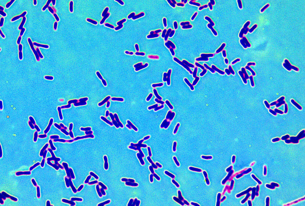 Палочка бифидобактерии. Lactobacillus Acidophilus под микроскопом. Лактобациллы Бревис. Лактобациллус плантарум. Лактобациллы бактерии.