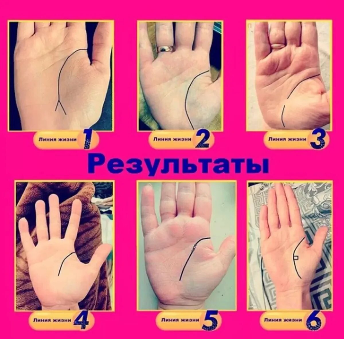 Виды линий жизни. Фото: blog.arcanum.ru