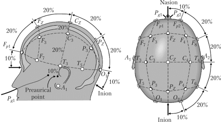 Схема наложения электродов ээг
