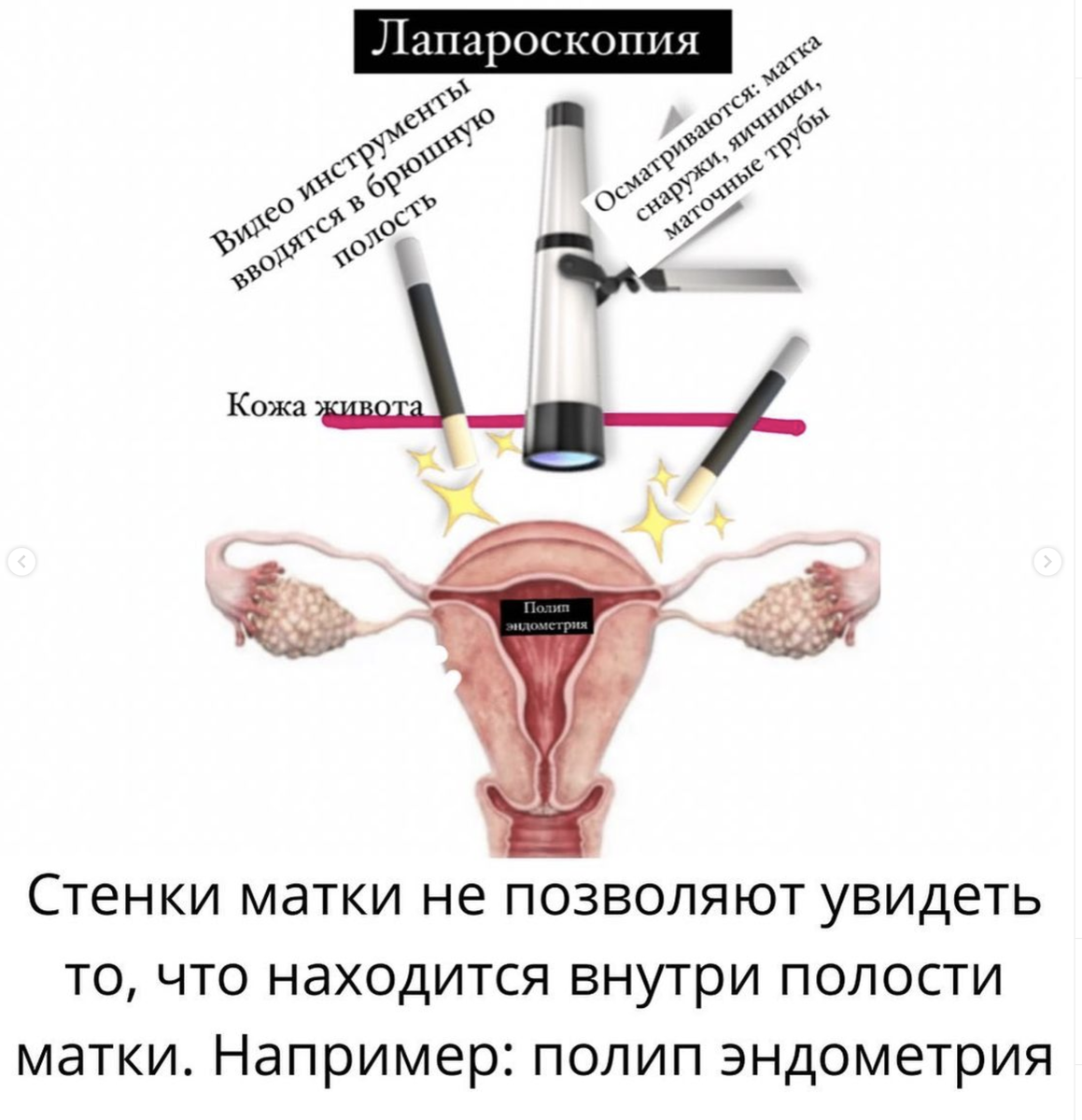 Дисплазия шейки матки - причины появления, симптомы заболевания, диагностика и способы лечения