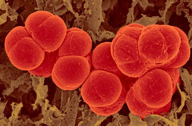 Фото: DENNIS KUNKEL MICROSCOPY/Science Photo Library/East NewsИм не страшен лед, кипяток и глубина, а некоторые из них живут вечно