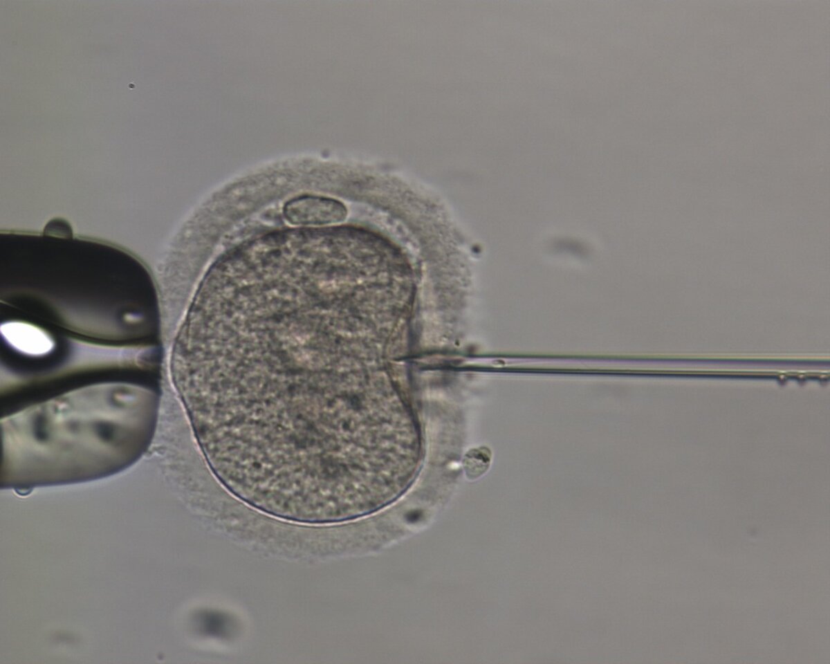 Игла плавно входит. Сперматозоид уже на финише. Увидели его?