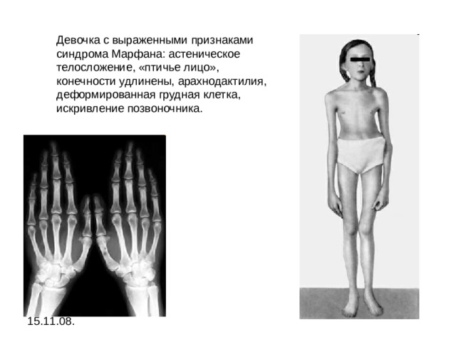 Ограничение доступа