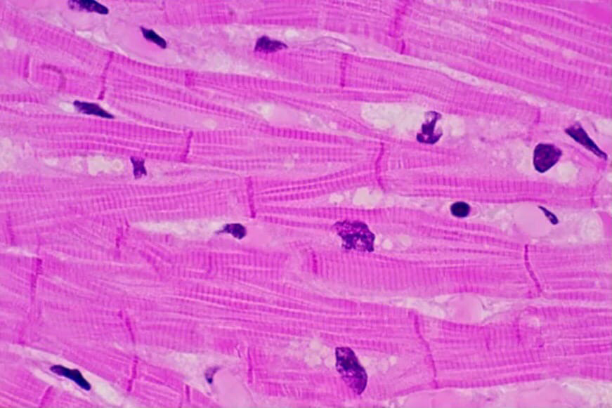 Поперечнополосатая мышечная ткань сердца